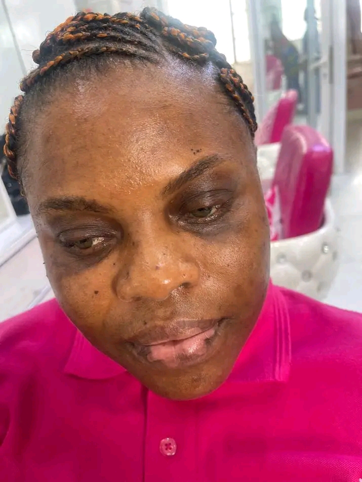 Cliente avant le soin